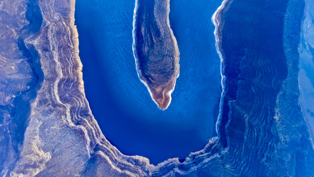 SANKO Üniversitesi'nde Radyasyon Onkolojisi Ünitesi Hasta Kabulüne Başladı - Sağlık haberi görseli